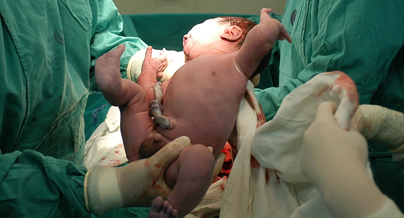É verdade que o parto normal dói muito?
